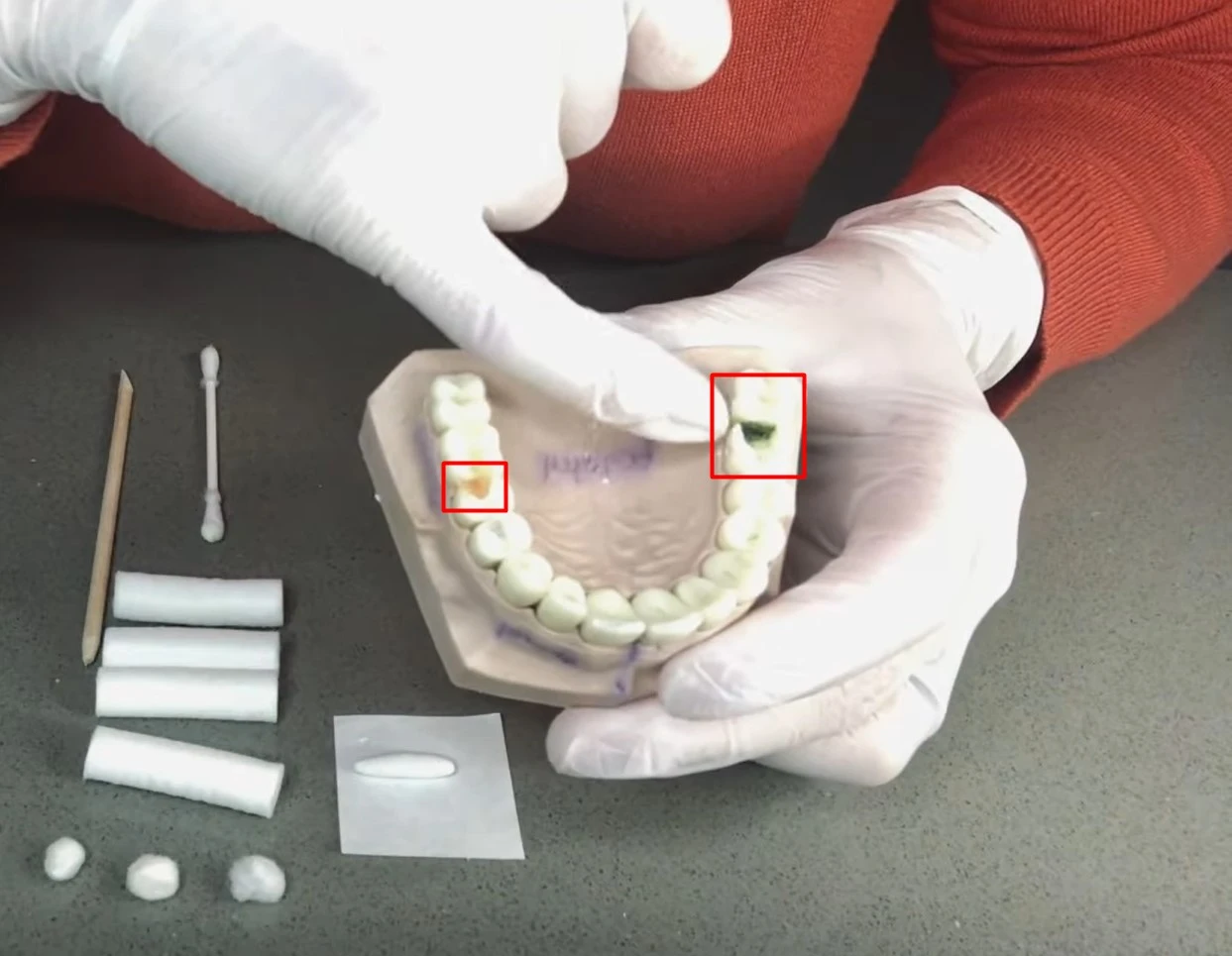 how-long-can-you-leave-a-cavity-untreated-cloudmineinc