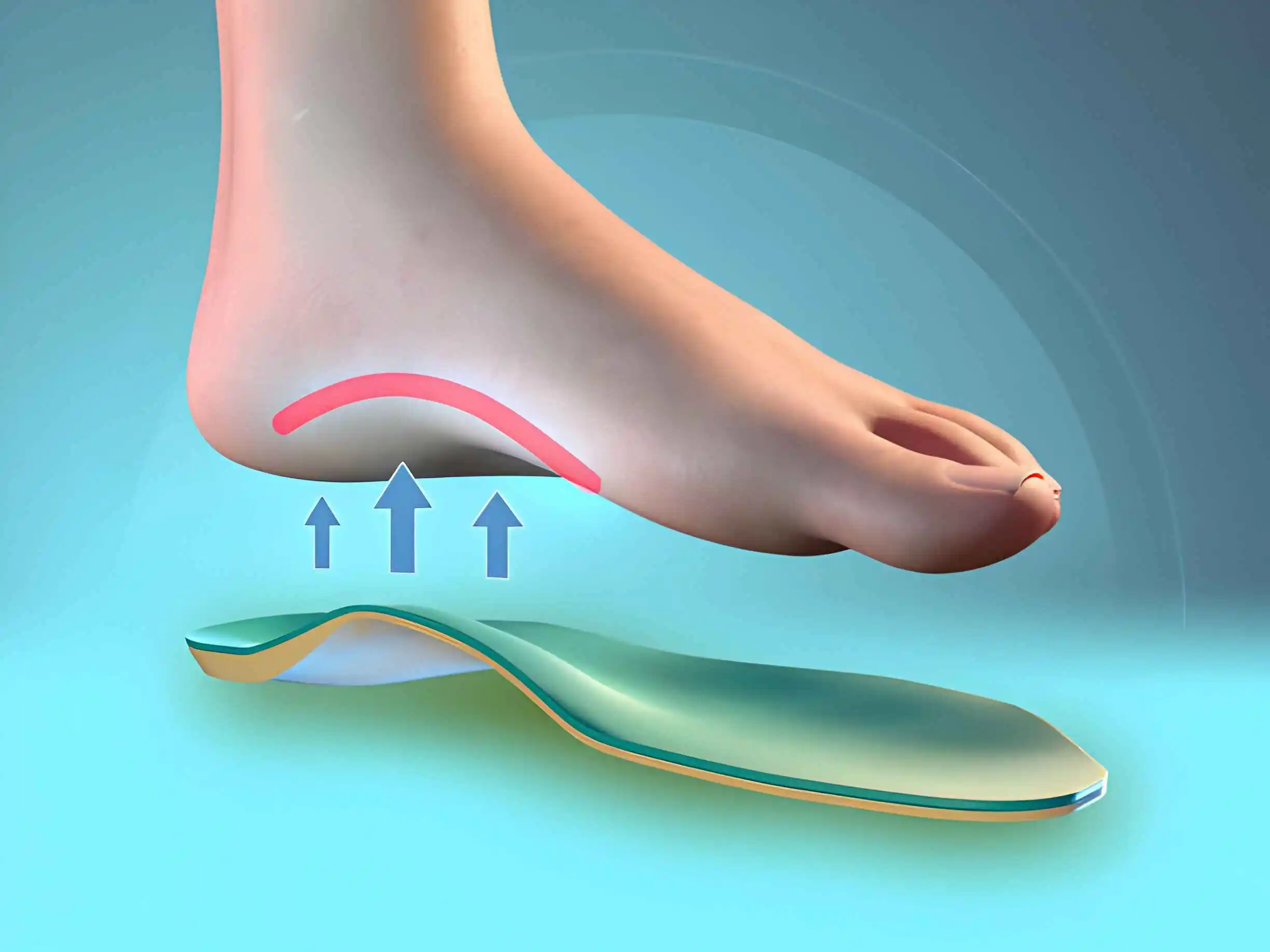 Choosing The Right Arch Support Insoles for Your Feet CloudMineInc