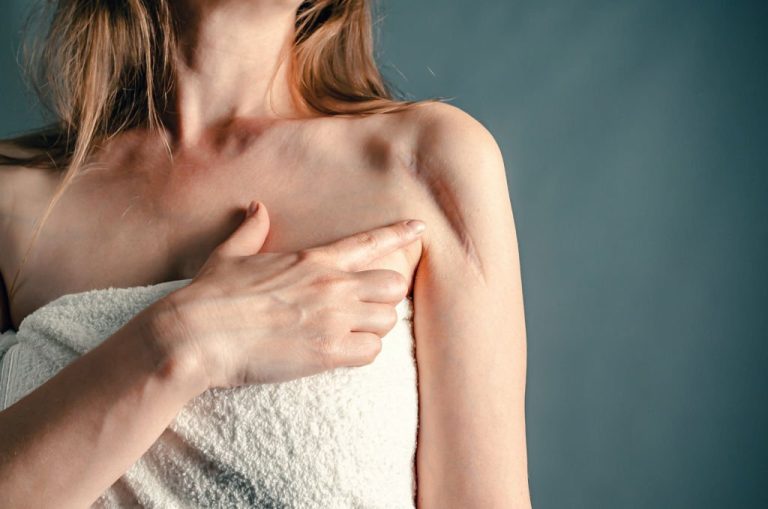 signs of infection after breast reduction
