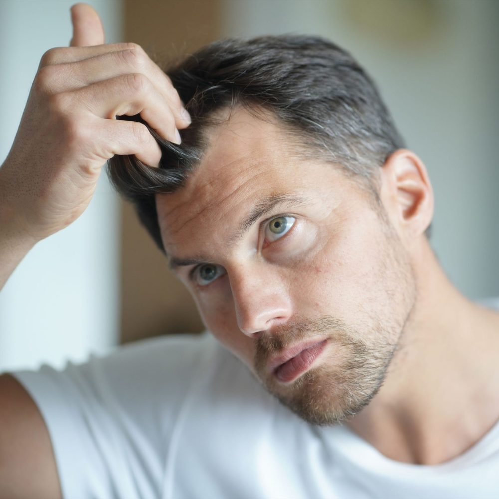 Scalp Eczema And Hair Loss: Are They Connected?