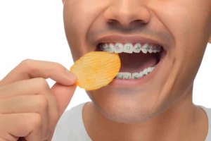 can you eat chips with braces